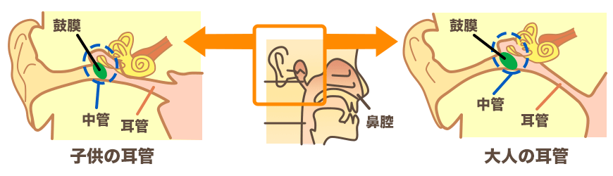 子どもの耳管は、大人と比べて太く短く、傾きも水平に近いのが特徴です